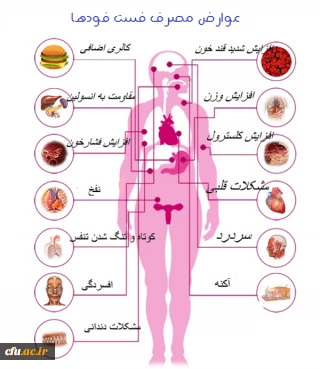 عوارض مصرف فست فودها