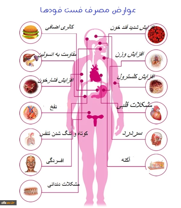 عوارض مصرف فست فود ها 2