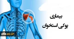 به مناسبت 28 مهر روز جهانی پوکی استخوان:

تهیه فایل آموزشی