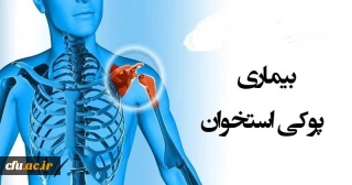 به مناسبت 28 مهر روز جهانی پوکی استخوان:

تهیه فایل آموزشی