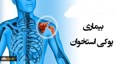 به مناسبت 28 مهر روز جهانی پوکی استخوان:

تهیه فایل آموزشی