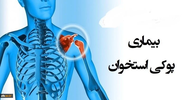 به مناسبت 28 مهر روز جهانی پوکی استخوان:

تهیه فایل آموزشی
